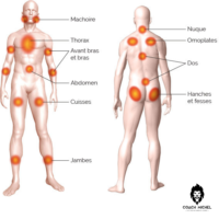 sophrologie, fibromyalgie